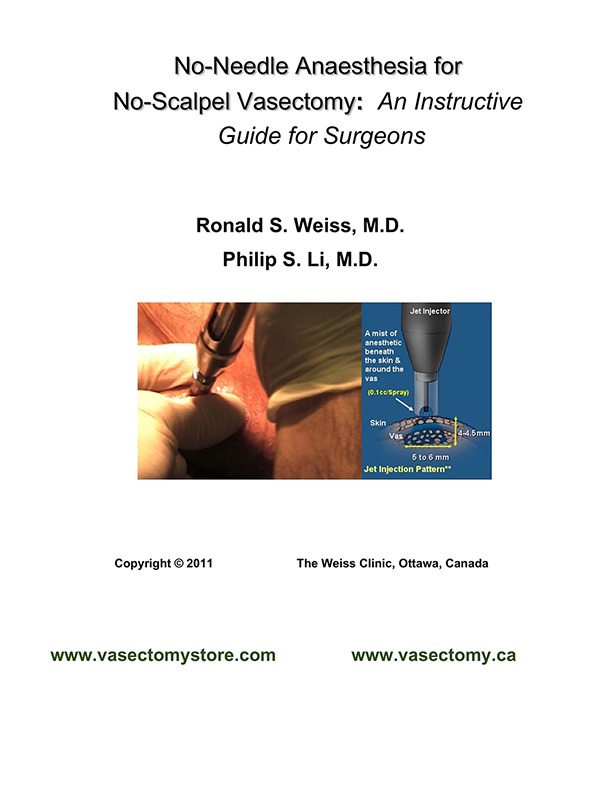 No Needle No Scalpel Vasectomy Guide